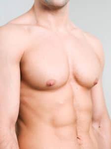Gynecomastian Newton MA | Male Breast Surgery Boston