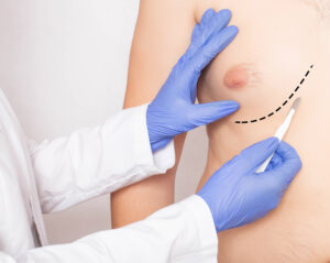 Male Breast Enlargement Causes. Dr. Richard Silverman, Boston, MA